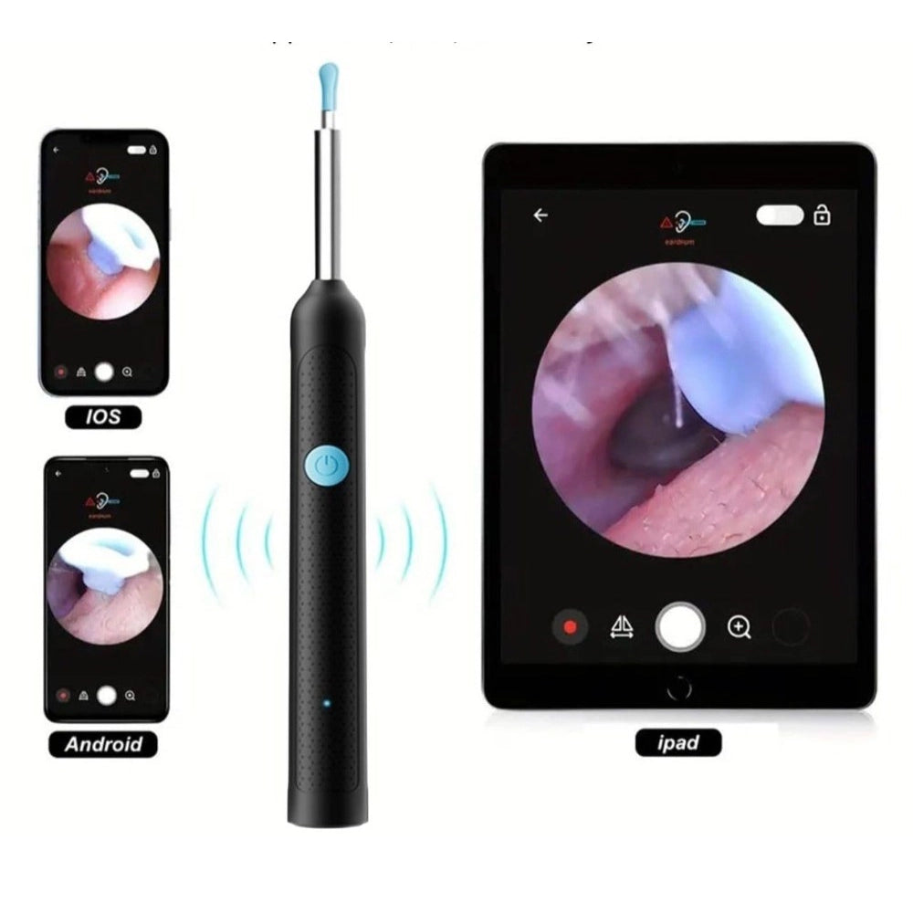 Earwax Cleaner With Camera (Multicolor )